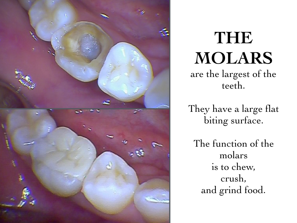 The Molars